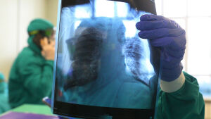 В Татарстане за год почти на 7% выросла заболеваемость туберкулезом